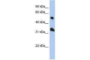 WB Suggested Anti-TSPAN33 Antibody Titration: 0. (TSPAN33 Antikörper  (Middle Region))