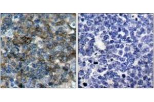 Immunohistochemistry analysis of paraffin-embedded human tonsil, using VASP (Phospho-Ser157) Antibody. (VASP Antikörper  (pSer157))