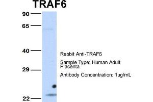 Host: Rabbit Target Name: TRAF6 Sample Type: Human Adult Placenta Antibody Dilution: 1. (TRAF6 Antikörper  (Middle Region))
