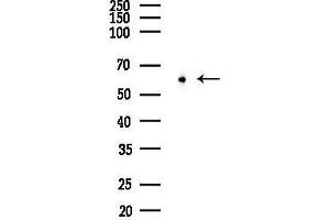 anti-Zinc Finger Protein 695 (ZNF695) (C-Term) antibody
