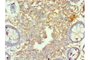 Immunohistochemistry of paraffin-embedded human colon tissue using ABIN7160219 at dilution of 1:100 (MORF4L1 Antikörper  (AA 1-100))