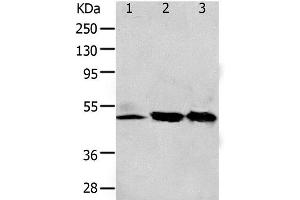 Western Blot analysis of 293T and K562 cell, Human fetal kidney tissue using F2R Polyclonal Antibody at dilution of 1:650 (PAR1 Antikörper)