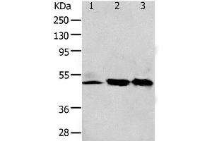 Western Blot analysis of 293T and K562 cell, Human fetal kidney tissue using F2R Polyclonal Antibody at dilution of 1:650 (PAR1 Antikörper)