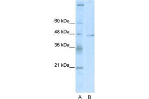 Western Blotting (WB) image for anti-Tumor Susceptibility Gene 101 (TSG101) antibody (ABIN2461785) (TSG101 Antikörper)