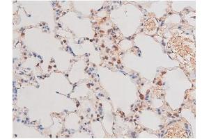 Immunohistochemistry (IHC) image for anti-Adducin 1 (Alpha) (ADD1) (pSer726) antibody (ABIN6255485)