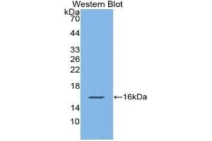 Detection of Recombinant MIg, Mouse using Polyclonal Antibody to Monokine Induced By Interferon Gamma (MIg)