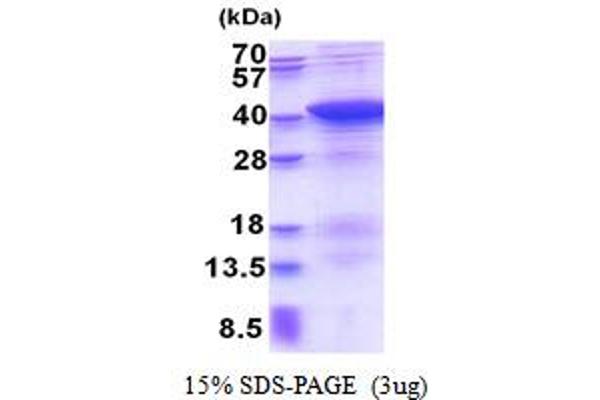 PDLIM1 Protein (AA 1-329) (His tag)