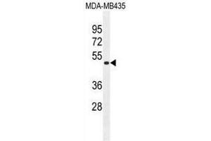 TAPT1 Antibody (C-term) western blot analysis in MDA-MB435 cell line lysates (35ug/lane). (TAPT1 Antikörper  (C-Term))