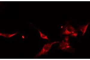 ABIN6275053 staining HeLa cells by IF/ICC. (DOCK1 Antikörper  (C-Term))