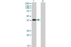 Western Blot analysis of ISL2 expression in transfected 293T cell line by ISL2 monoclonal antibody (M03), clone 1D9. (ISL2 Antikörper  (AA 261-358))