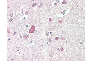 Anti-PTGDS / PGDS antibody IHC staining of human brain, cortex. (PTGDS Antikörper  (AA 27-38))