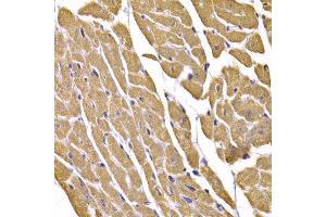 Immunohistochemistry of paraffin-embedded mouse heart using SLC2A4 antibody (ABIN5995371) at dilution of 1/100 (40x lens). (GLUT4 Antikörper)