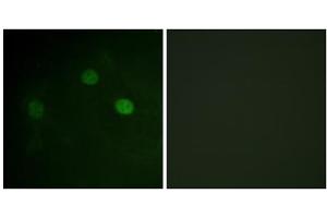 Immunofluorescence analysis of COS7 cells, using CDK1 (Phospho-Thr14) antibody. (CDK1 Antikörper  (pThr14))