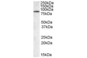 Image no. 1 for anti-Tripartite Motif Containing 3 (TRIM3) (N-Term) antibody (ABIN374306) (TRIM3 Antikörper  (N-Term))