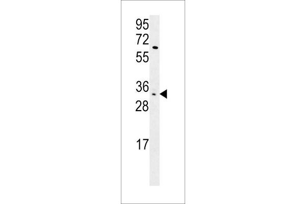 KIR2DS3 Antikörper  (C-Term)