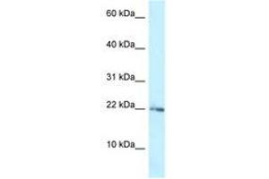 Image no. 1 for anti-Ribosomal Protein L23A (RPL23A) (AA 33-82) antibody (ABIN6747774) (RPL23A Antikörper  (AA 33-82))