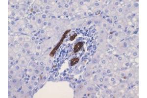 Immunohistochemistry (IHC) image for anti-Keratin 19 (KRT19) (C-Term) antibody (ABIN870577) (Cytokeratin 19 Antikörper  (C-Term))