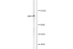 Western blot analysis of extracts from K562 cells. (ABL1 Antikörper)