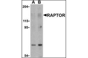 Western blot analysis of Raptor in L1210 cell lysate with this product at (A) 2 and (B) 4 μg/ml. (RAPTOR Antikörper  (N-Term))