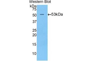 Western blot analysis of the recombinant protein. (TGM1 Antikörper  (AA 504-737))