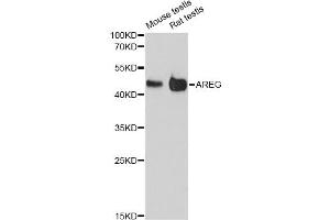 Western blot analysis of extracts of various cell lines, using AREG antibody (ABIN6290061) at 1:3000 dilution. (Amphiregulin Antikörper)