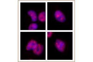 SMARCA2 / BRM antibody (mAb) tested by Immunofluorescence. (SMARCA2 Antikörper  (AA 48-214))