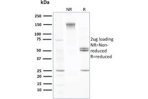 SDS-PAGE Analysis Purified Transthyretin Mouse Monoclonal Antibody (CPTC-TTR-1). (TTR Antikörper)