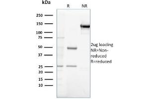 SDS-PAGE Analysis Purified Gastrin Mouse Monoclonal Antibody (GAST/2632).