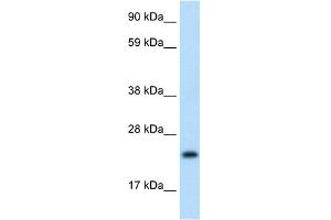 WB Suggested Anti-ASCL1 Antibody Titration:  1.