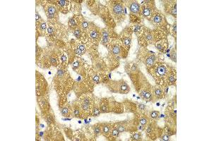 Immunohistochemistry of paraffin-embedded human liver injury using MYO1C antibody at dilution of 1:100 (x40 lens). (Myosin IC Antikörper)