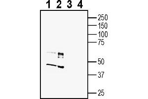 Western blot analysis of mouse brain membranes (lanes 1 and 3) and rat brain membranes (lanes 2 and 4):1-2. (C3AR1 Antikörper  (Extracellular))