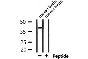 Western blot analysis of extracts from mouse brain, using RNF167 Antibody. (RNF167 Antikörper  (Internal Region))