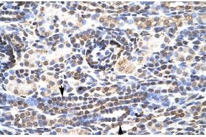 Rabbit Anti-KL9 Antibody  Paraffin Embedded Tissue: Human Kidney Cellular Data: Epithelial cells of renal tubule Antibody Concentration: 4. (KLF9 Antikörper  (N-Term))