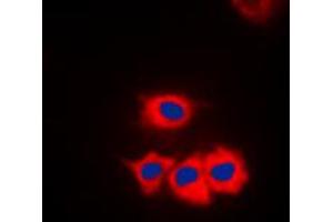 Immunofluorescent analysis of CK1 gamma 1 staining in Jurkat cells.