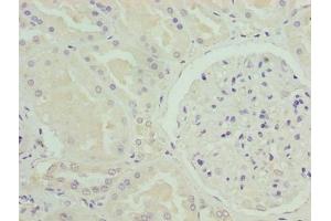 Immunohistochemistry of paraffin-embedded human kidney tissue using ABIN7161010 at dilution of 1:100 (NADPH Oxidase 4 Antikörper  (AA 210-424))