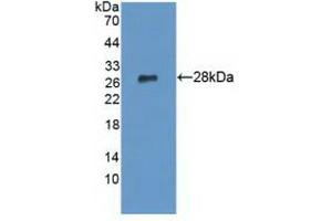 Detection of Recombinant LYPLA1, Human using Polyclonal Antibody to Lysophospholipase I (LYPLA1) (LYPLA1 Antikörper  (AA 1-230))