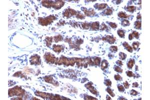 Immunohistochemistry (IHC) image for anti-Mesothelin (MSLN) (AA 273-407) antibody (ABIN6939032)
