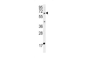 MKRN3 Antibody (Center) (ABIN651835 and ABIN2840417) western blot analysis in MDA-MB435cell line lysates (15 μg/lane). (MKRN3 Antikörper  (AA 160-189))