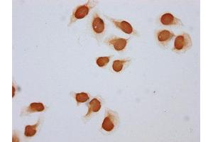 Immunocytochemistry analysis of ABIN7139147 diluted at 1:5 and staining in Hela cells (treated with 30mM sodium butyrate for 4h) performed on a Leica BondTM system. (Histone H2B Antikörper  (acLys108))