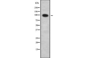 Western blot analysis SLC9A2 using COLO205 whole cell lysates (SLC9A2 Antikörper  (Internal Region))