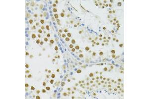 Immunohistochemistry of paraffin-embedded mouse testis using BRCA1 antibody (ABIN5997316) at dilution of 1/100 (40x lens). (BRCA1 Antikörper)