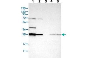 Western blot analysis of Lane 1: RT-4, Lane 2: U-251 MG, Lane 3: Human Plasma, Lane 4: Liver, Lane 5: Tonsil with BPGM polyclonal antibody  at 1:250-1:500 dilution. (BPGM Antikörper)
