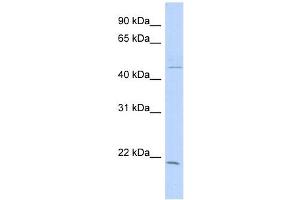 CIB3 antibody used at 1 ug/ml to detect target protein.