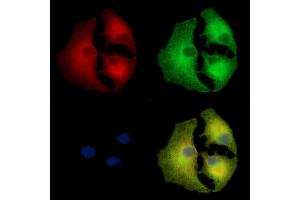 ABIN7097181 and ABIN7101249 staining  cells by IF/ICC. (LRGUK Antikörper)