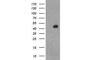 Image no. 1 for anti-LIM Homeobox 1 (LHX1) (AA 100-362) antibody (ABIN1490805) (LHX1 Antikörper  (AA 100-362))