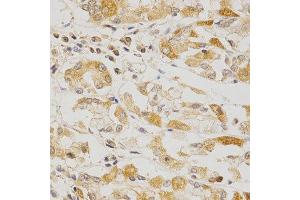 Immunohistochemistry of paraffin-embedded human stomach using OLR1 antibody at dilution of 1:200 (x400 lens). (OLR1 Antikörper  (AA 58-273))