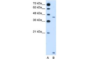 WB Suggested Anti-SLC46A3 Antibody Titration:  2. (SLC46A3 Antikörper  (N-Term))