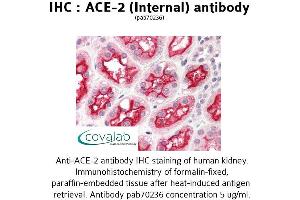 Image no. 1 for anti-Angiotensin I Converting Enzyme 2 (ACE2) (Internal Region) antibody (ABIN1731442) (ACE2 Antikörper  (Internal Region))