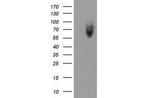 Western Blotting (WB) image for anti-Kelch-Like ECH-Associated Protein 1 (KEAP1) antibody (ABIN1499015) (KEAP1 Antikörper)