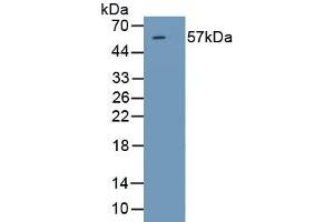 Detection of Recombinant SRD5a1, Rat using Polyclonal Antibody to Steroid 5 Alpha Reductase 1 (SRD5a1)